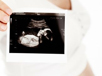 Ultraschalluntersuchung im zweiten Trimester.